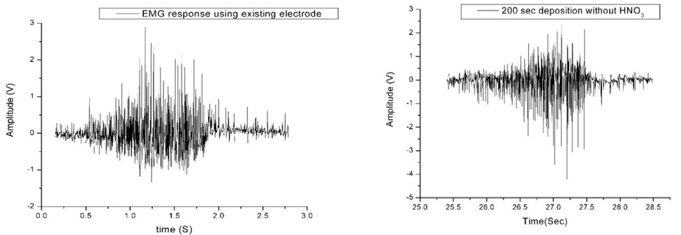 EMG-result